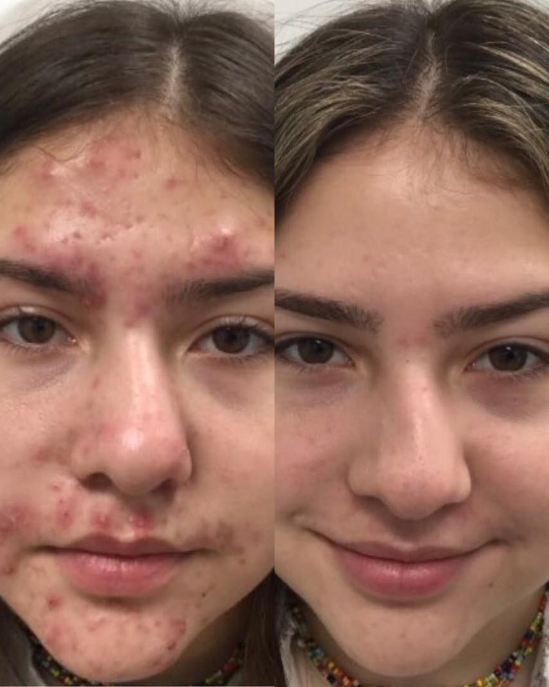 Before and after