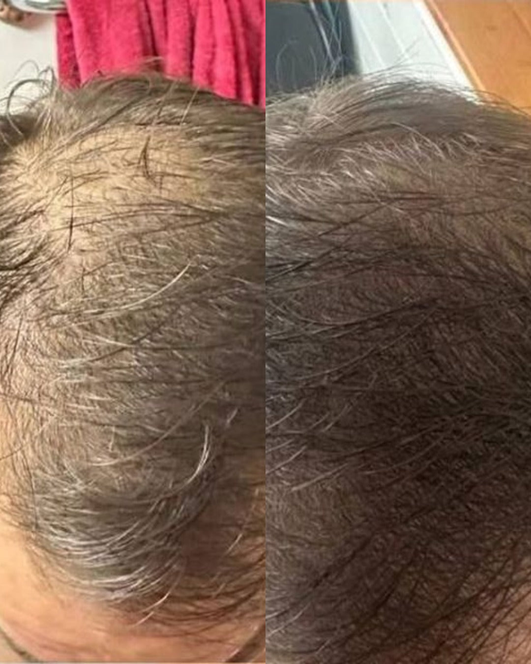 Before and after