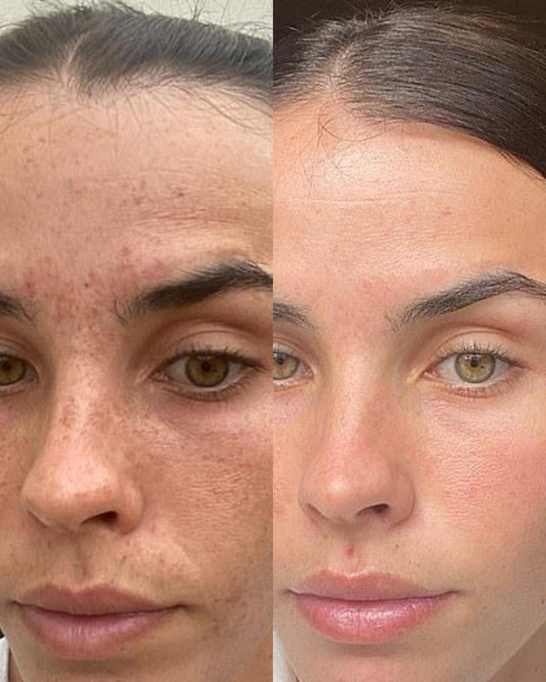 Before and after