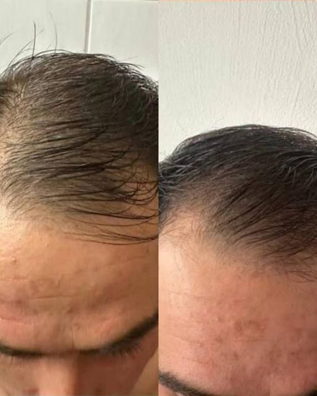 Before and after