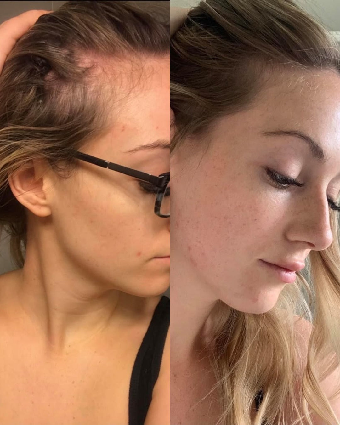 Before and after