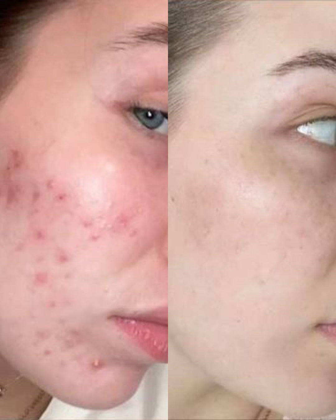 Before and after