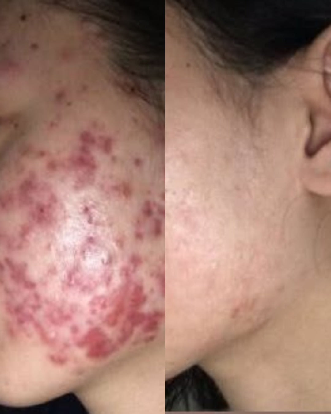 Before and after