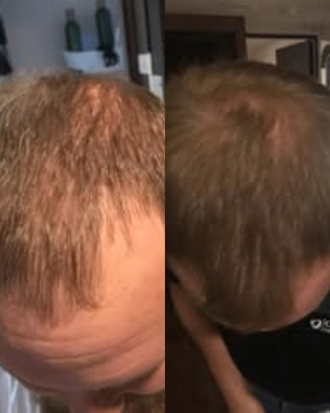 Before and after
