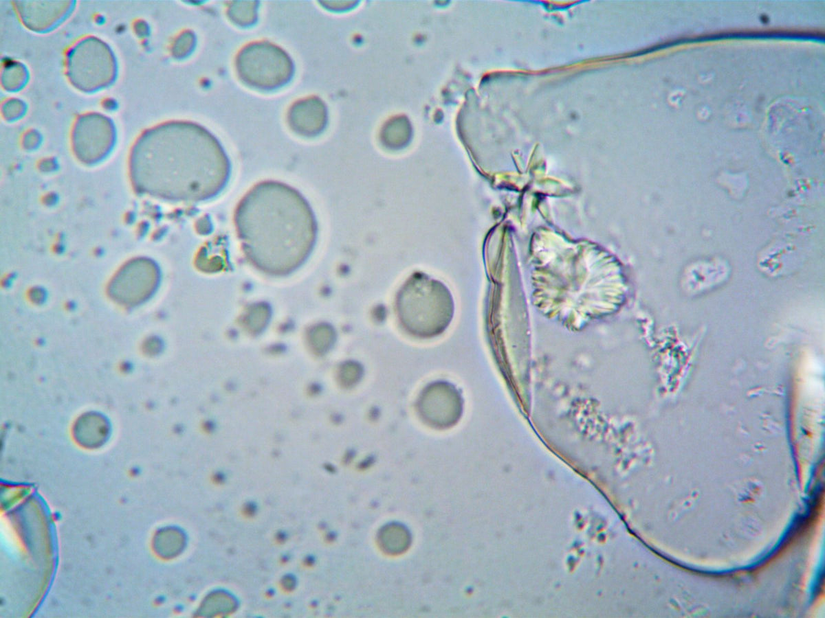 What Are Stem Cells? A Plain-Language Guide to the Body's Repair System