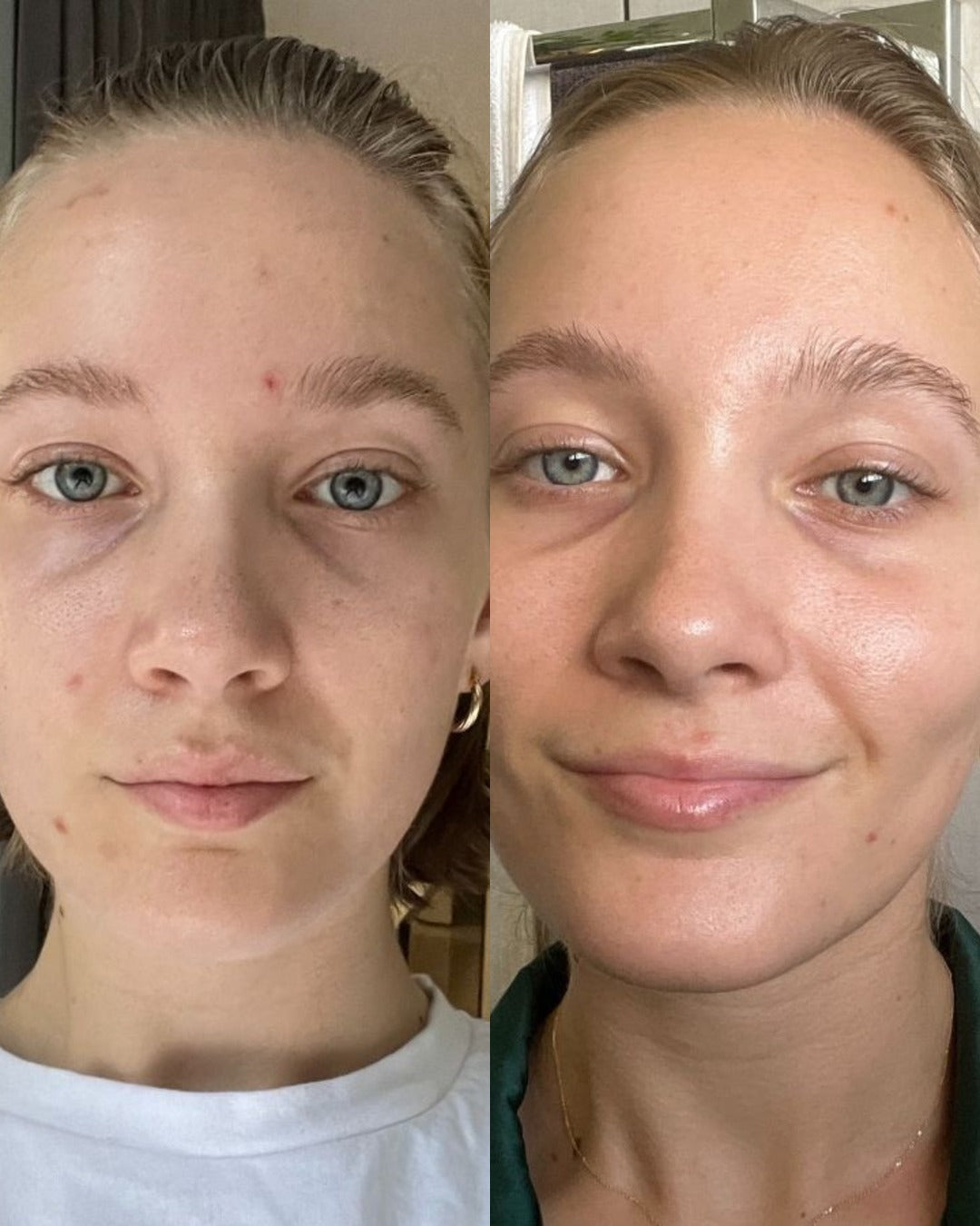 Before and after