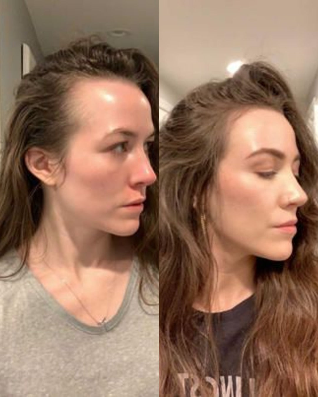 Before and after