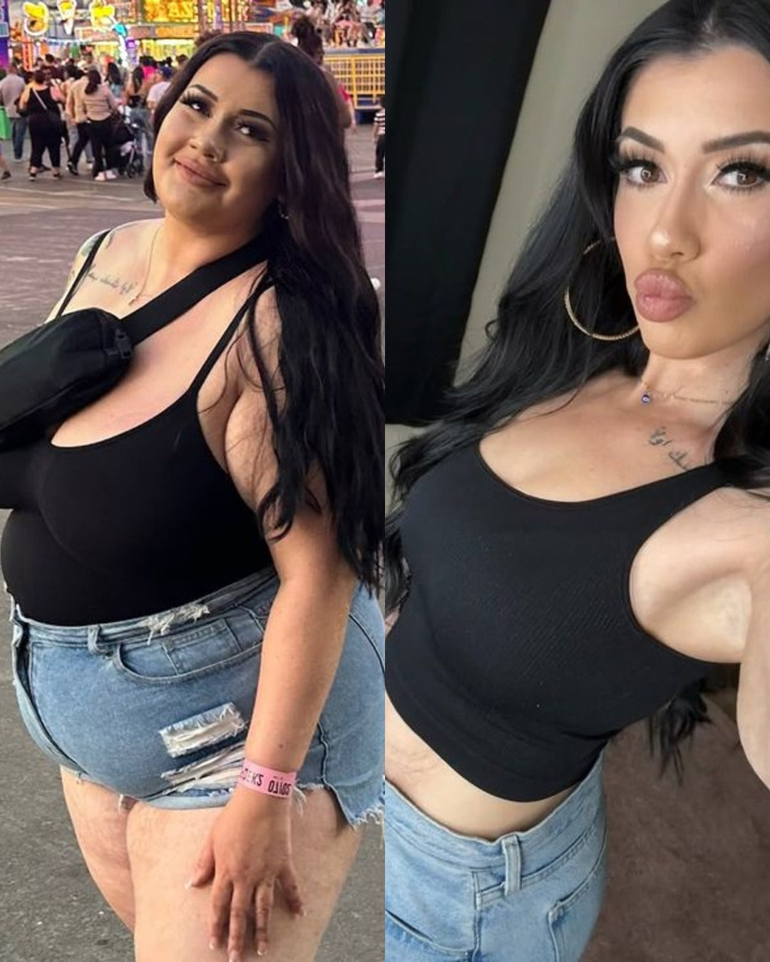Before and after