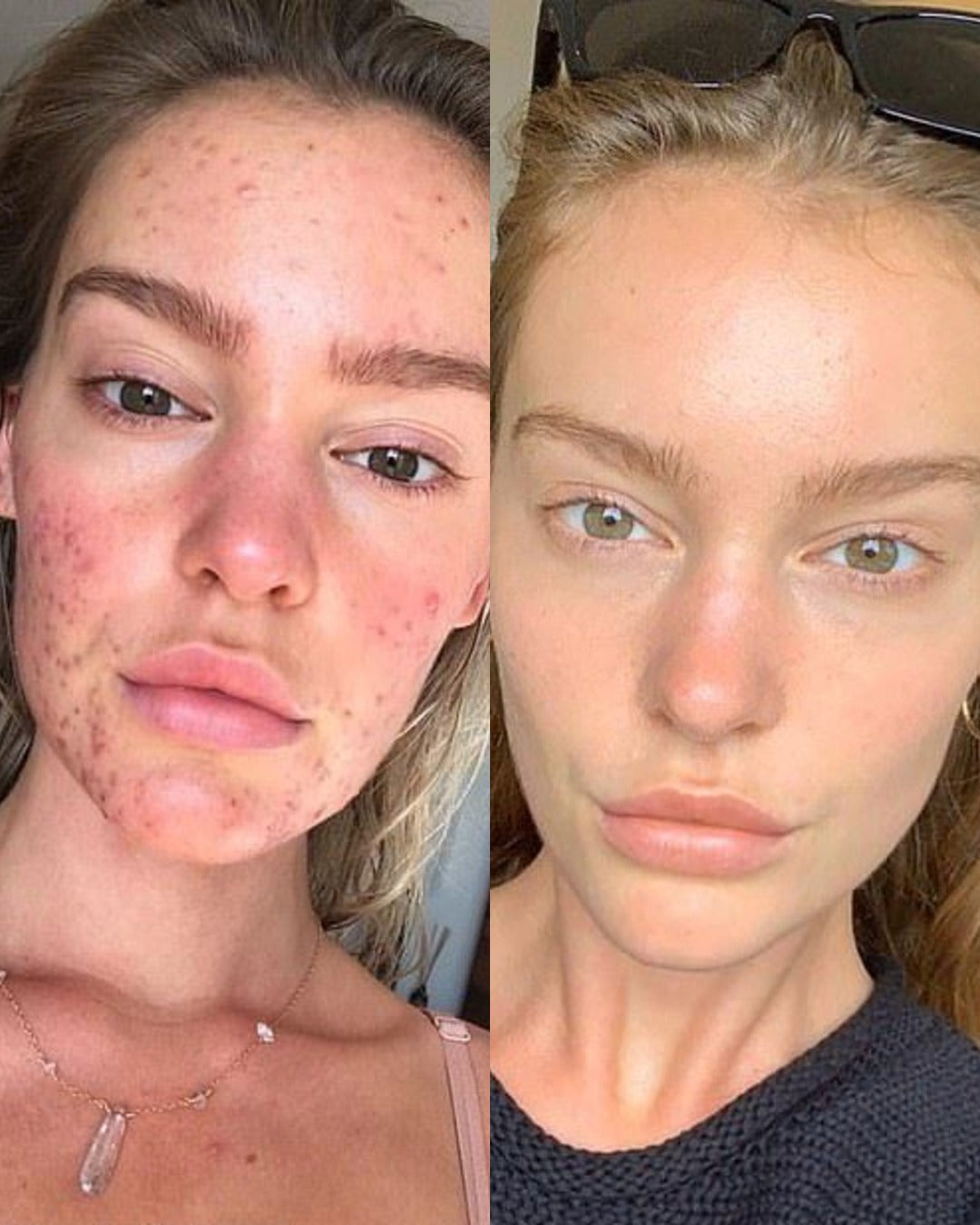 Before and after