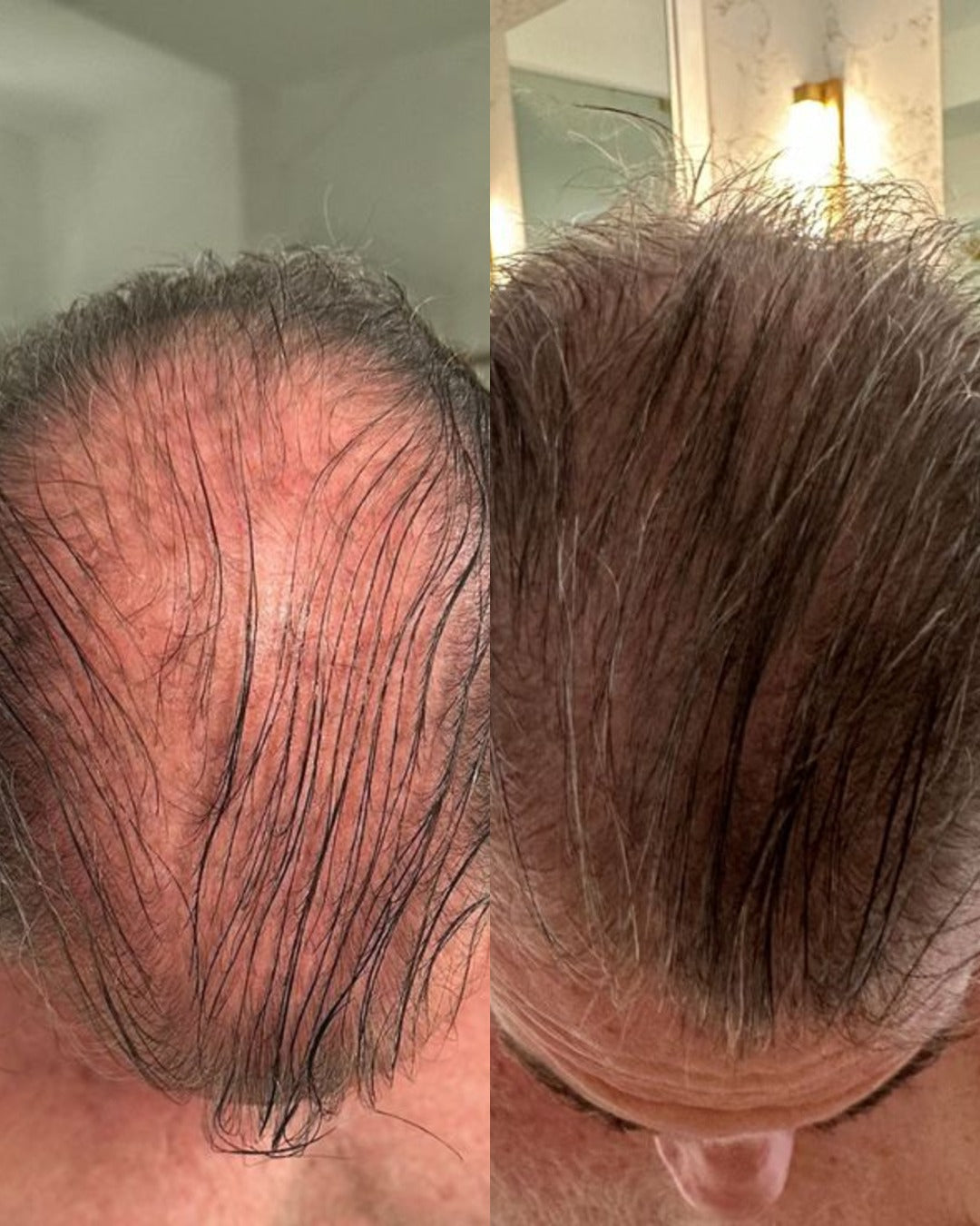 Before and after