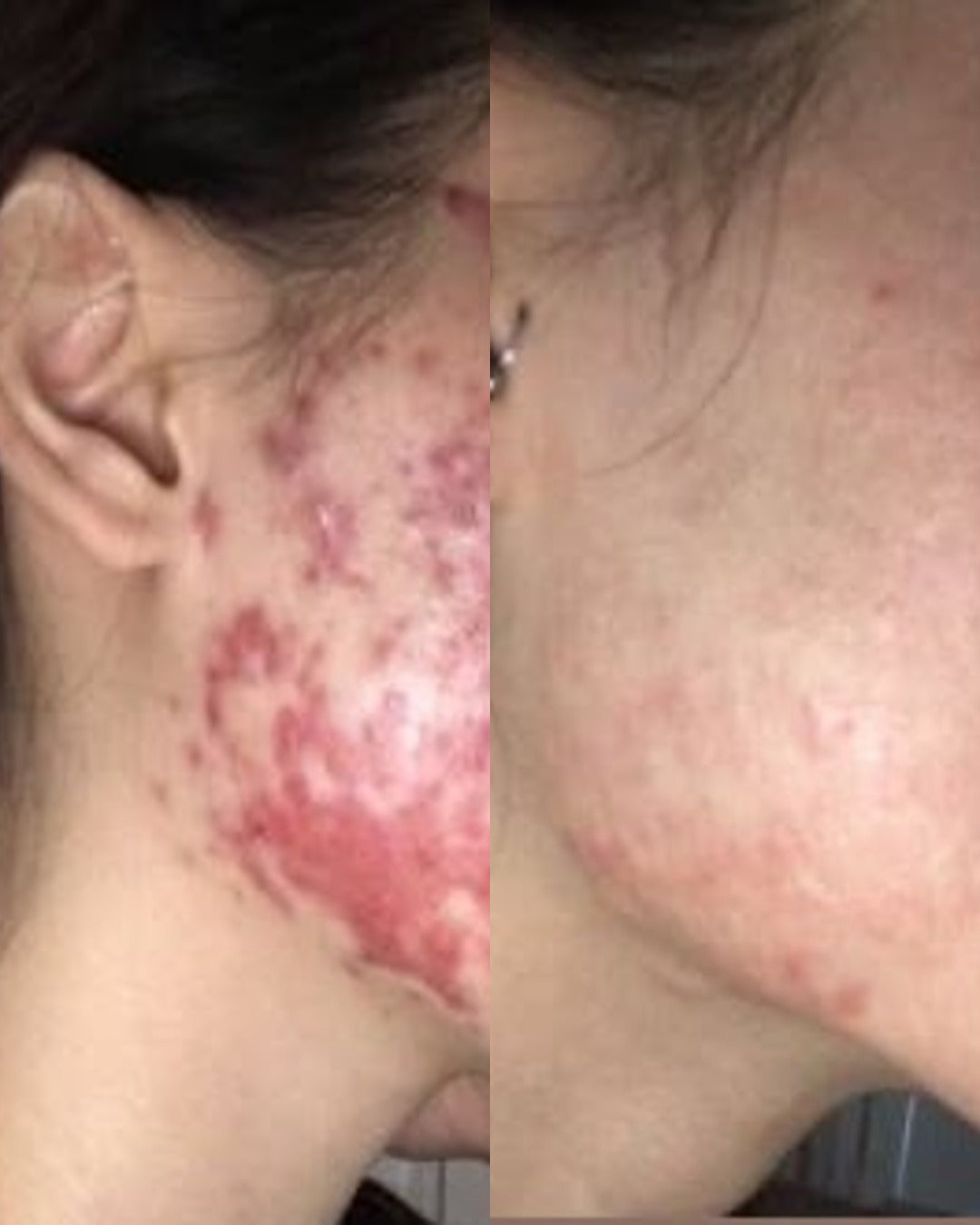 Before and after
