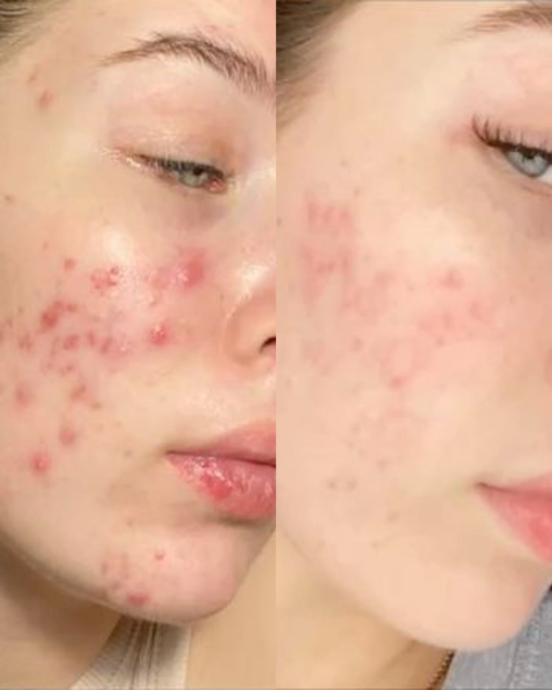 Before and after
